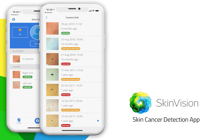 SkinVision - Skin Cancer Melanoma Detection App image 1